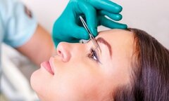 Người bị cận thị có nên cắt mí mắt?