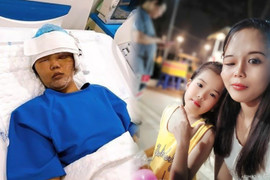 Mẹ đơn thân bị khối u nửa mặt và hành trình 'lột xác' sau 3 cuộc đại phẫu