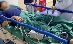 Nam sinh nhập viện vì bị phạt đứng lên ngồi xuống 200 lần