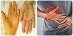 Cảnh báo 9 dấu hiệu ung thư gan giai đoạn đầu