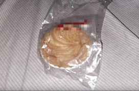 Bé 6 tuổi ngộ độc sau tiệc Trung thu: Lập hội đồng đánh giá quy trình tiếp nhận 