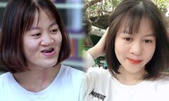 Nữ sinh bị hở hàm ếch lột xác ngoạn mục, cả mẹ đẻ cũng không nhận ra