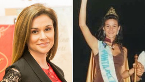 Đột quỵ sau phẫu thuật thẩm mỹ, hoa hậu người Argentina qua đời 