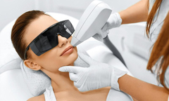 Có nên triệt lông bằng laser?