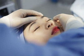 Nhấn mí kiêng ăn gì để mí nhanh lành?