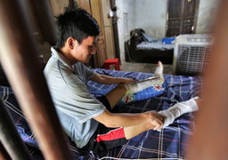 Người đàn ông bị máy cắt nghiền nát 2 chân, vét sạch cửa nhà lo tiền điều trị