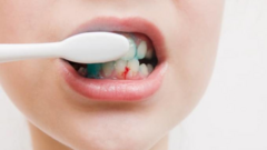 Dấu hiệu khi đánh răng cảnh báo gan nhiễm mỡ