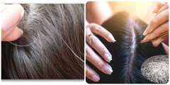 Vì sao không nên nhổ tóc bạc?