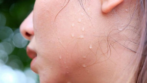 Mồ hôi muối và mồ hôi dầu khác nhau thế nào?