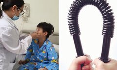 Xem bạn bẻ 'đồ long đao', bé trai bị đập gãy xương mũi