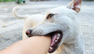 Theo bố đến chỗ làm, bé gái ở Hà Nội bị 4 con chó tấn công 