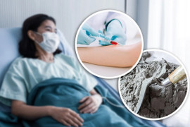 Lang băm chữa ung thư bằng xi măng khiến người phụ nữ tử vong