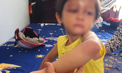 Bắt giam cha nuôi bạo hành bé gái 4 tuổi ở Cà Mau