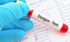 Nên xét nghiệm sốt xuất huyết ở ngày thứ mấy?