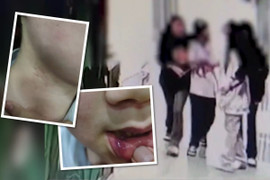 Người cha treo thưởng 34 triệu đồng cho ai tìm được kẻ đánh đập con mình