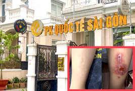 Chân mưng mủ, biến chứng nặng sau khi trị sẹo tại Phòng khám Quốc tế Sài Gòn