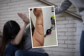 Chịu 20 nhát chém để cứu bạn cùng phòng, cô gái đau buồn trước sự vô ơn của bạn