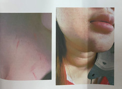 Bị nhóm phụ huynh đánh hội đồng, nữ sinh lớp 12 ở TP.HCM 'kêu cứu'