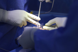 Cách kiểm tra co thắt bao xơ sau nâng ngực