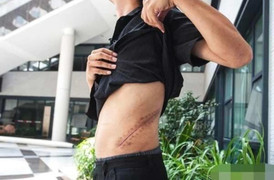 Cuộc sống bi thảm của nam sinh bán thận mua iPhone 