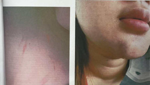 Vụ nữ sinh lớp 12 'tố' bị phụ huynh đánh hội đồng: Trường THPT Sài Gòn lên tiếng