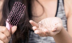 Mẹo chăm sóc tóc lúc giao mùa