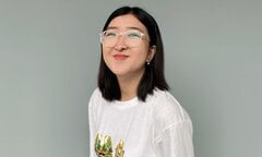 Cô gái hở hàm ếch 'lột xác' xinh đẹp sau 3 lần mổ tái tạo gương mặt