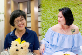 ‘Cô gái chỉ có nửa khuôn mặt’ lột xác sau 3 cuộc đại phẫu