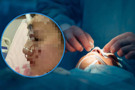 Thẩm mỹ viện tuyển nhân viên để ép sửa mũi với giá cao rồi tìm cớ sa thải