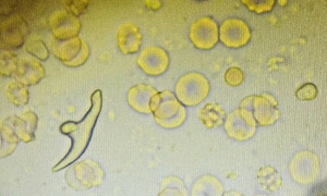 Thói quen ăn uống nhiều người Việt thích nhưng dễ bị nhiễm sán chó