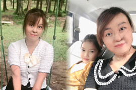 Sau 20 lần mổ, cô gái bị chồng đổ xăng đốt hôm mùng 2 Tết hiện ra sao?