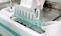 Mất tiền oan từ tờ giấy xét nghiệm ung thư tại nhà