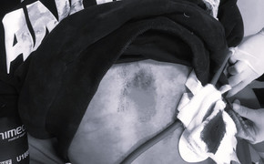 Sắp đưa đi hỏa thiêu, thi thể bị công an giữ khám nghiệm vì nghi ngờ án mạng