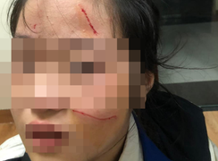 Nữ sinh Hà Nội đánh em lớp dưới chảy máu mặt bị buộc thôi học 6 ngày