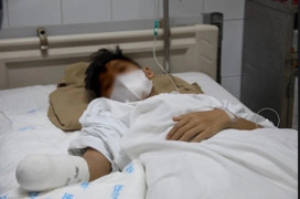 Nghịch pháo ngày Tết, thiếu niên mất bàn tay phải 