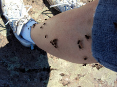 Vì sao ruồi thích bám vào cơ thể người?