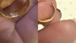 Cô gái phát hiện mối nguy hiểm chết người trong túi nhờ nhẫn vàng đổi màu