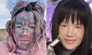 Người phụ nữ xăm kín cơ thể gây sốt khi khoe ảnh không còn hình xăm