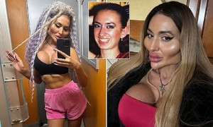 Nhan sắc kỳ lạ của cô gái có gò má to nhất thế giới