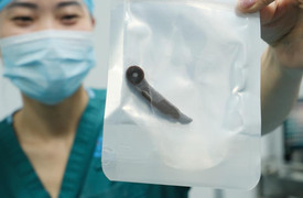 Nhai nắm cỏ đắp vết đứt tay, người đàn ông bị đỉa dài 6 cm chui vào cổ họng