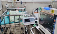 Bác sĩ thực hiện 2 cuộc phẫu thuật cứu em bé 1 ngày tuổi bị dị tật tim