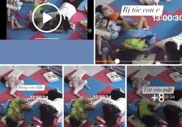 Xác minh thông tin 1 cháu bé tự kỷ bị bạo hành ở Đà Nẵng