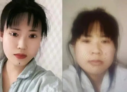 Thất vọng với kết quả phẫu thuật thẩm mỹ, cô gái nhảy sông ngay khi xuất viện