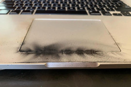 Máy tính phát nổ, bé trai bỏng nặng