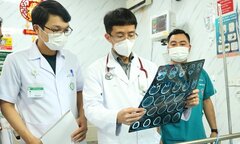 'Phao cứu sinh' giúp giảm nguy cơ đột quỵ não tái phát