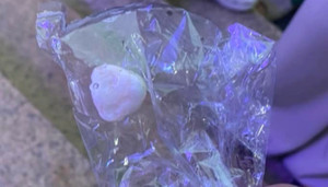 Đang trồng cây, bất ngờ bị viên sỏi lọt vào đường thở