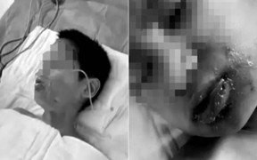 Ép bạn uống nước sôi, vụ bạo lực học đường khiến dân mạng Trung Quốc sôi sục