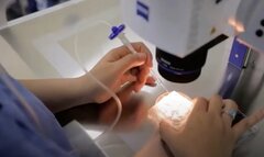Tuổi đôi mươi đã lão hoá buồng trứng