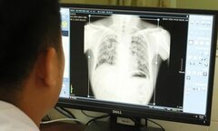 Vụ 6 công nhân tử vong do bụi phổi: Chưa cơ quan chức năng nào nhận trách nhiệm