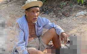 Bình Định: Truy tìm xe ben cán nát chân cụ ông 85 tuổi rồi bỏ chạy